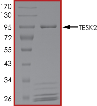 SDS-PAGE - Recombinant human TESK2 protein (AB140418), expandable thumbnail