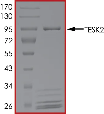 SDS-PAGE - Recombinant human TESK2 protein (AB140418)