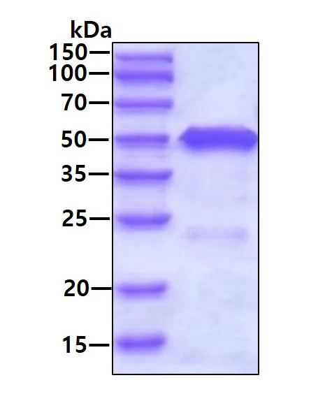 SDS-PAGE - Recombinant Human Testin protein (AB99213)