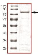 SDS-PAGE - Recombinant Human TET1 protein (AB140810), expandable thumbnail