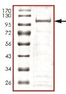 SDS-PAGE - Recombinant Human TET1 protein (AB140810)