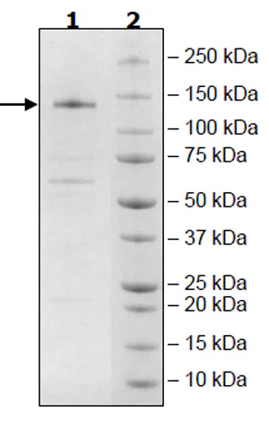 SDS-PAGE - Recombinant Human Tet2 protein (6x His tag C-Terminus + DDDDK N-Terminus) (AB271755)