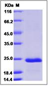 SDS-PAGE - Recombinant Human Tetranectin protein (His tag) (AB276491), expandable thumbnail