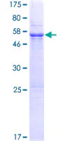 SDS-PAGE - Recombinant Human TEX101 protein (GST tag N-Terminus) (AB164415)