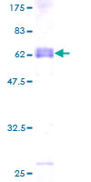 Recombinant Human TEX264 protein