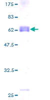 SDS-PAGE - Recombinant Human TEX264 protein (AB162527)