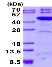 SDS-PAGE - Recombinant Human TFB2M protein (AB134620)