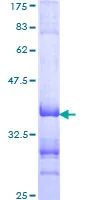 SDS-PAGE - Recombinant Human TFE3 protein (AB152741)