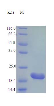 Recombinant human TFF2 protein (Active)