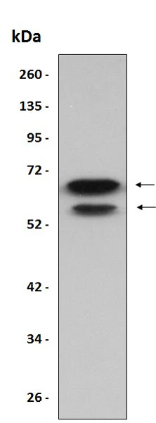 Western blot - Recombinant Human TFIIE alpha/GTF2E1 protein (His tag) (AB204777)