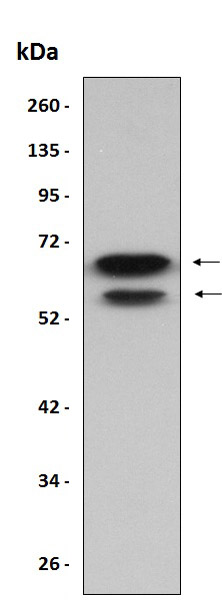 Recombinant Human TFIIE alpha/GTF2E1 protein (His tag)