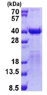 SDS-PAGE - Recombinant Human TFIIS protein (His tag N-Terminus) (AB156967)