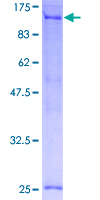 SDS-PAGE - Recombinant Human TFIP11 protein (AB161769)