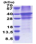 SDS-PAGE - Recombinant Human TFPI protein (denatured) (His tag N-Terminus) (AB171716)
