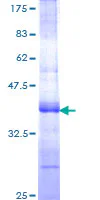 SDS-PAGE - Recombinant Human TFPI protein (GST tag N-Terminus) (AB152742)