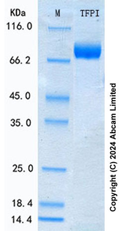 SDS-PAGE - Recombinant Human TFPI Protein Standard (His tag) (AB316467), expandable thumbnail