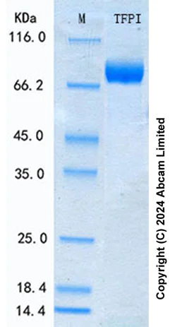 SDS-PAGE - Recombinant Human TFPI Protein Standard (His tag) (AB316467)