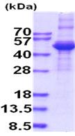 SDS-PAGE - Recombinant Human TGF beta 3 protein (denatured) (AB202611), expandable thumbnail