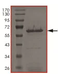 SDS-PAGE - Recombinant human TGF beta Receptor I (mutated T204D) protein (Active) (AB186088)