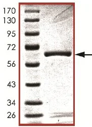 SDS-PAGE - Recombinant human TGF beta Receptor I protein (AB105908)