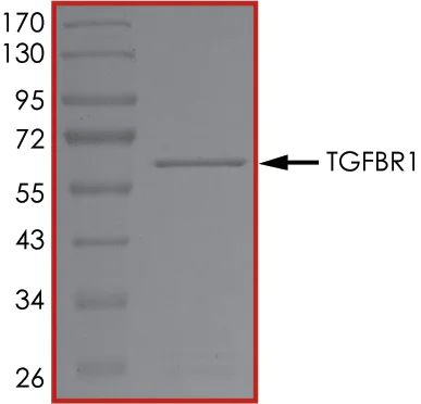 SDS-PAGE - Recombinant human TGF beta Receptor I protein (AB105908)