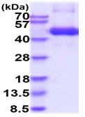 SDS-PAGE - Recombinant Human TGF beta Receptor I protein (Fc Chimera His Tag) (AB229364)