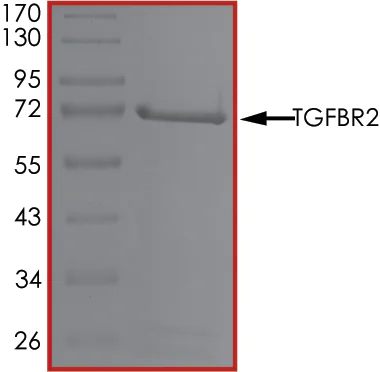 SDS-PAGE - Recombinant human TGF beta Receptor II protein (AB63173)