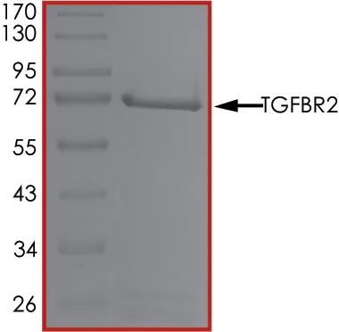 SDS-PAGE - Recombinant human TGF beta Receptor II protein (GST tag N-Terminus) (AB63173)