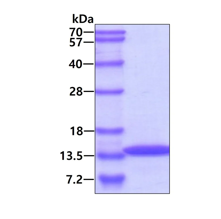 SDS-PAGE - Recombinant Human TGFBI protein (AB86218)