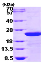 SDS-PAGE - Recombinant Human TGFBI protein (AB86989)