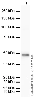 Western blot - Recombinant Human TGFBI protein (Tag Free) (AB86989)
