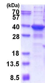 SDS-PAGE - Recombinant Human TGIFLX protein (His tag N-Terminus) (AB177618)