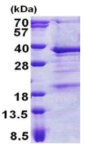 SDS-PAGE - Recombinant Human THAP3 protein (His tag N-Terminus) (AB167870)