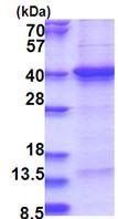 SDS-PAGE - Recombinant Human THAP7 protein (denatured) (His tag N-Terminus) (AB181931)