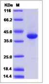 SDS-PAGE - Recombinant Human ThB protein (Fc Chimera) (AB276647)