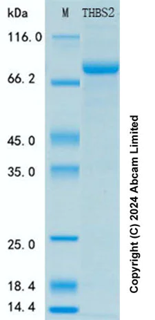 SDS-PAGE - Recombinant Human THBS2 Protein Standard (His tag) (AB316644)
