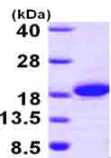 SDS-PAGE - Recombinant Human THEM2 protein (AB101158)