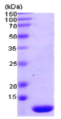 SDS-PAGE - Recombinant human Thioredoxin 2 protein (AB78845), expandable thumbnail