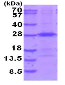 SDS-PAGE - Recombinant Human THOC7 protein (AB202166)