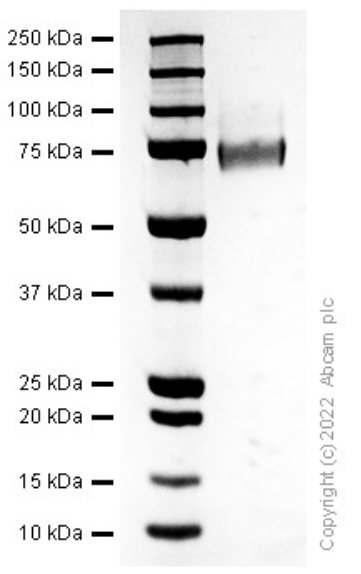 SDS-PAGE - Recombinant Human Thrombomodulin Protein (AB307351), expandable thumbnail