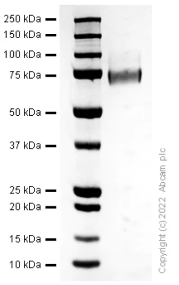 SDS-PAGE - Recombinant Human Thrombomodulin Protein (AB307351)