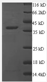 SDS-PAGE - Recombinant Human Thrombospondin 1 protein (His tag) (AB241233)