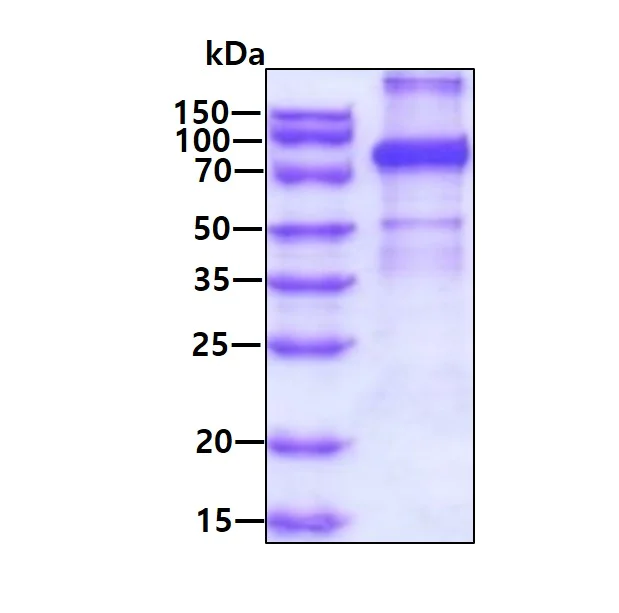 SDS-PAGE - Recombinant Human ThrRS protein (His tag N-Terminus) (AB123210)