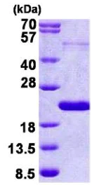 SDS-PAGE - Recombinant Human THRSP protein (AB156982)