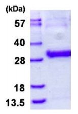 SDS-PAGE - Recombinant Human Thymidine Kinase 1/TK1 protein (His tag N-Terminus) (AB128431)