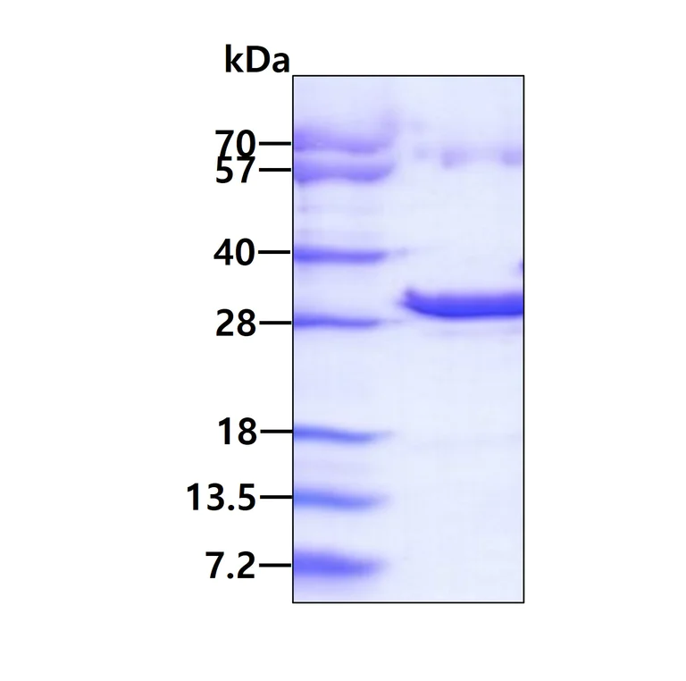 SDS-PAGE - Recombinant Human Thymidine Kinase 2 protein (His tag N-Terminus) (AB130043)