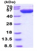 SDS-PAGE - Recombinant Human Thymidine Phosphorylase protein (His tag N-Terminus) (AB101169)