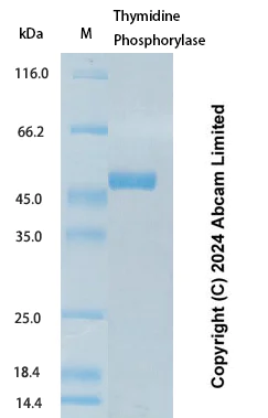 SDS-PAGE - Recombinant Human Thymidine Phosphorylase Protein Standard (His tag) (AB323051)