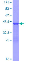 SDS-PAGE - Recombinant Human Thymosin alpha 1 protein (AB159283)
