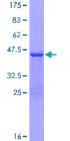 SDS-PAGE - Recombinant Human Thymosin alpha 1 protein (GST tag N-Terminus) (AB159283)